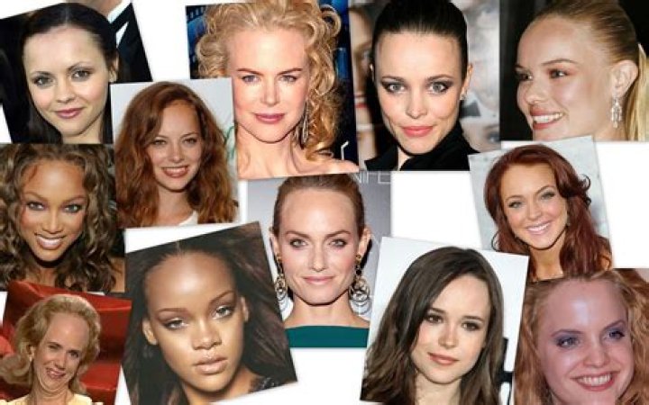 Celebrities with large foreheads