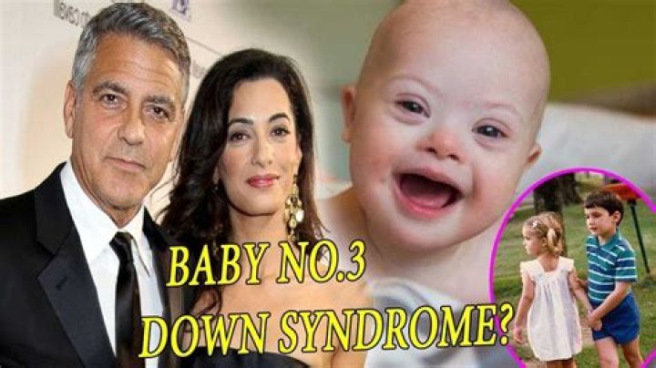 Does George Clooney's Son Have Down Syndrome? - A Closer Look