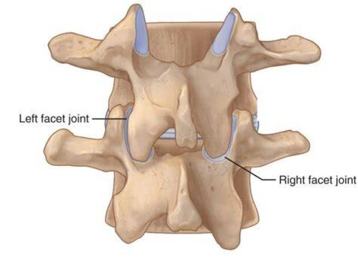 Facet Joint Injuries My Family Physio
