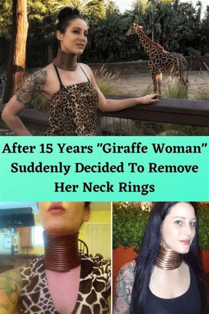 Giraffe Woman Removes Rings After Fiver Years How She Looks Now