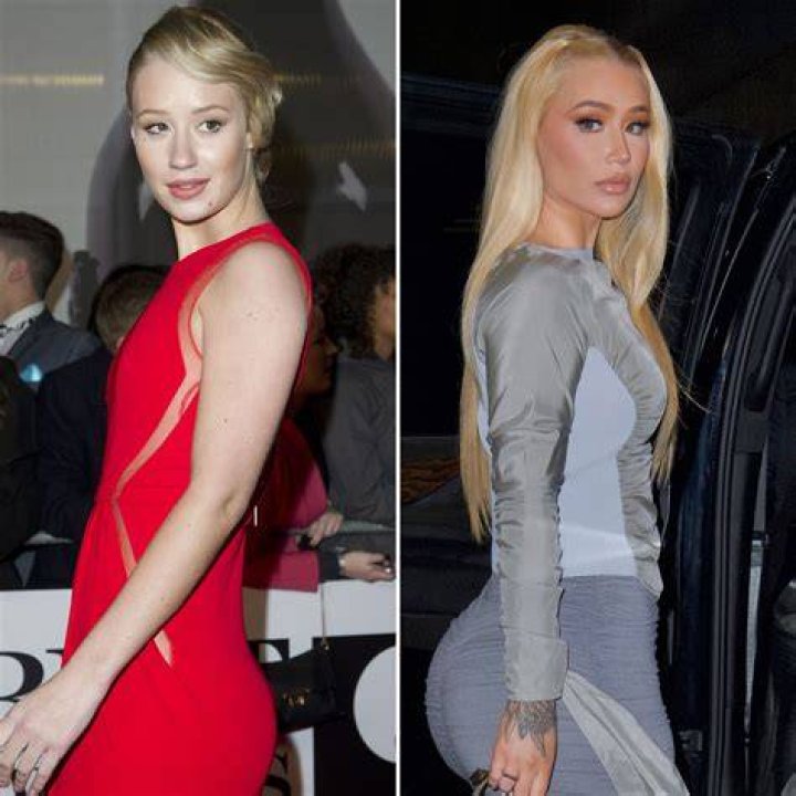 Iggy Azalea KylieTristan