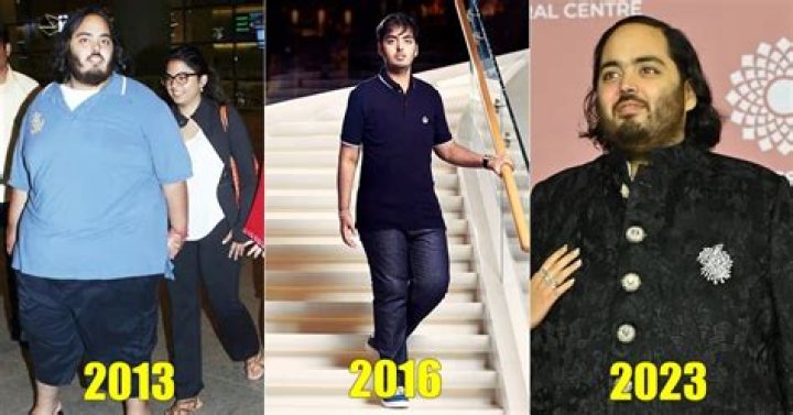 Is Anant Ambani Sick?