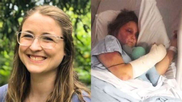 Is Kirra Hart Alive what Happened After Recent Brutal Assault?