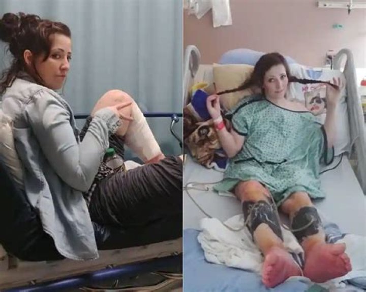 Kelly Ronahan Legs Amputated Was Her Leg Sores Due To Munchausen