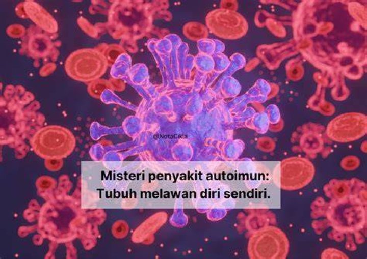 Merungkai Misteri Penyakit &ldquo;Systemic Lupus Erythematosus&rdquo; (SLE