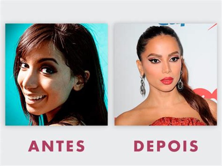 O Antes e Depois das Estrelas do Rock P&aacute;gina 16 de 19 Paula Musique