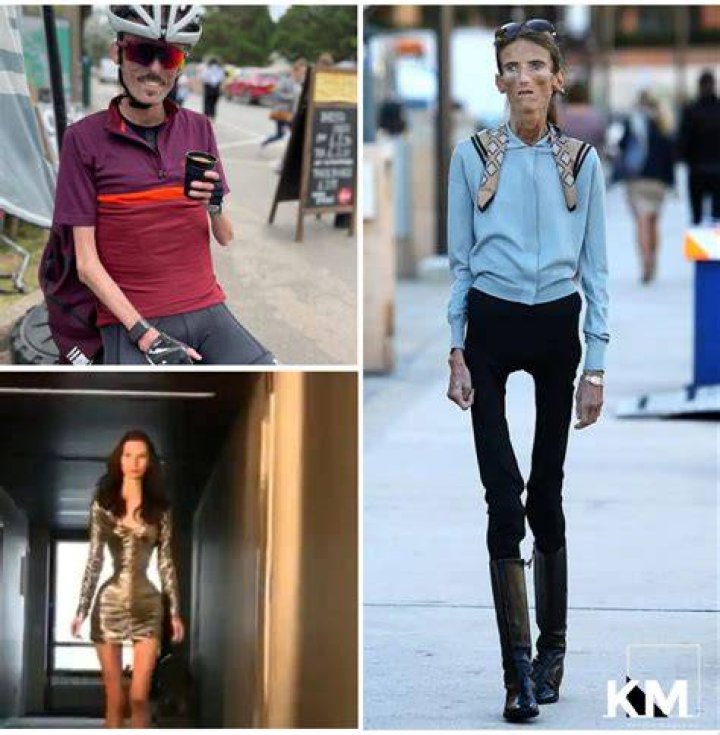 The Skinniest Person In The World (10 Of Them) Fieracad