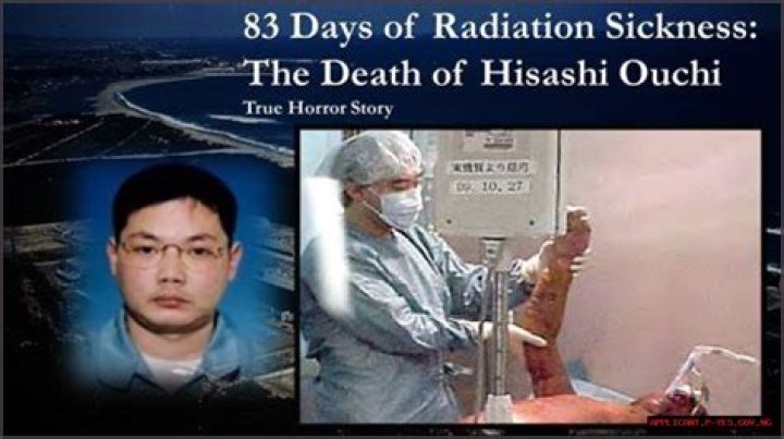 The Tragic Death Of Hisashi Ouchi A Medical Mystery Unveiled